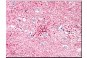 Human Brain, Basal Ganglia: Formalin-Fixed, Paraffin-Embedded (FFPE) (SLC1A4 Antikörper)