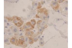 Detection of HEXb in Human Liver Tissue using Polyclonal Antibody to Hexosaminidase B Beta (HEXb) (HEXB Antikörper  (AA 315-456))