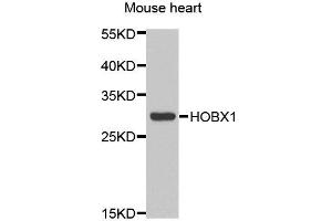 Western blot analysis of extracts of Mouse heart cell line, using HOXB1 antibody. (HOXB1 Antikörper)