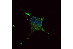 Fluorescent confocal image of SY5Y cells stained with ELP2 antibody.