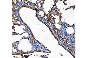 IHC analysis of Liver Carboxylesterase 1/CES1 using anti-Liver Carboxylesterase 1/CES1 antibody (ABIN7602719). (CES1 Antikörper  (AA 99-206))