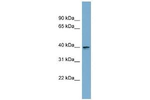 ASPHD2 antibody used at 1 ug/ml to detect target protein. (ASPHD2 Antikörper  (Middle Region))