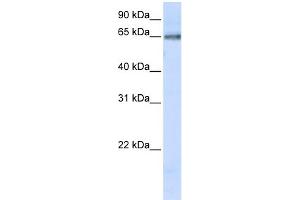 WB Suggested Anti-DCLRE1C Antibody Titration:  0. (DCLRE1C Antikörper  (C-Term))