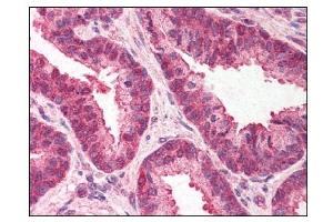 Image no. 1 for anti-Transmembrane Emp24-Like Trafficking Protein 10 (TMED10) (C-Term) antibody (ABIN303302) (TMED10 Antikörper  (C-Term))