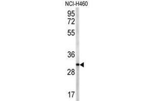 Western blot analysis of TRAP antibody (N-term) in NCI-H460 cell line lysates (35ug/lane). (CD40 Ligand Antikörper  (N-Term))
