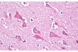 Immunohistochemistry (IHC) image for anti-NADH Dehydrogenase (Ubiquinone) Fe-S Protein 7, 20kDa (NADH-Coenzyme Q Reductase) (NDUFS7) (Internal Region) antibody (ABIN571200)