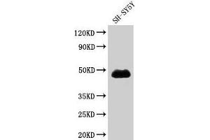 Western Blot Positive WB detected in: SH-SY5Y whole cell lysate All lanes: NADK antibody at 1. (NADK Antikörper  (AA 1-300))