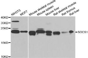 Western blot analysis of extracts of various cell lines, using SOCS1 antibody. (SOCS1 Antikörper)
