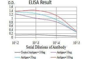 Black line: Control Antigen (100 ng);Purple line: Antigen (10ng); Blue line: Antigen (50 ng); Red line:Antigen (100 ng) (TTF1 Antikörper  (AA 1-150))