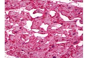 Immunohistochemistry (IHC) image for anti-Fatty Acid Binding Protein 3, Muscle and Heart (FABP3) (AA 44-55) antibody (ABIN2450546)