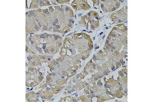 Immunohistochemistry of paraffin-embedded human stomach using TRPC3 antibody (ABIN5995383) (40x lens). (TRPC3 Antikörper)