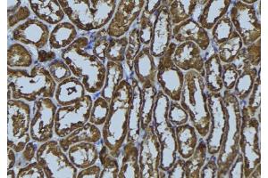 ABIN6272406 at 1/100 staining Rat kidney tissue by IHC-P. (RAB34 Antikörper  (Internal Region))