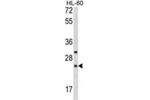 Western blot analysis of RGS1 Antibody (N-term) in HL-60 cell line lysates (35ug/lane). (RGS1 Antikörper  (N-Term))