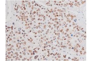 Immunohistochemistry (IHC) image for anti-LIM Domain Kinase 2 (LIMK2) (pSer283) antibody (ABIN6256239)