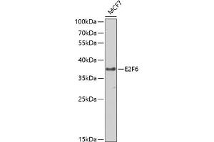 Western blot analysis of extracts of MCF-7 cells, using E2F6 antibody (ABIN1679632, ABIN1679631, ABIN5664137 and ABIN6219769) at 1:1000 dilution. (E2F6 Antikörper  (AA 1-281))