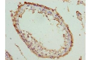Immunohistochemistry of paraffin-embedded human testis tissue using ABIN7166711 at dilution of 1:100 (MOV1 (AA 601-900) Antikörper)