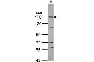WB Image Sample (30 ug of whole cell lysate) A: NT2D1 7. (TP53BP2 Antikörper)