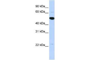 Human MCF-7; WB Suggested Anti-RP13-102H20. (ARHGAP36 Antikörper  (Middle Region))