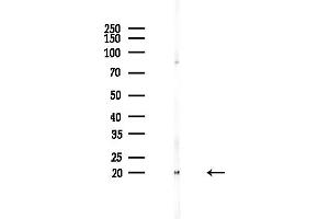 anti-Heat Shock 27kDa Protein 3 (HSPB3) (Internal Region) antibody