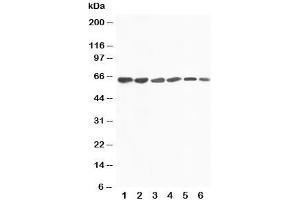 Western blot testing of FMO4 antibody and Lane 1:  rat liver;  2: mouse liver;  3: human SMMC-7721;  4: (m) HEPA;  5: (h) A431;  6: (h) MCF-7 cell lysate.