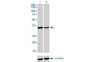Western blot analysis of FMR1 over-expressed 293 cell line, cotransfected with FMR1 Validated Chimera RNAi (Lane 2) or non-transfected control (Lane 1). (FMR1 Antikörper  (AA 121-220))