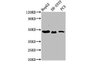 Western Blot Positive WB detected in: HepG2 whole cell lysate, SH-SY5Y whole cell lysate, PC-3 whole cell lysate All lanes: CXorf36 antibody at 3. (CXORF36 Antikörper  (AA 311-405))