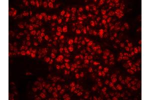 Immunofluorescence (IF) image for anti-Replication Protein A2, 32kDa (RPA2) (pSer4), (pSer8) antibody (ABIN7449013) (RPA2 Antikörper  (pSer4, pSer8))