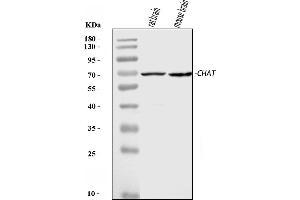 Western blot analysis of Choline Acetyltransferase/CHAT using anti-Choline Acetyltransferase/CHAT antibody (ABIN7599964).