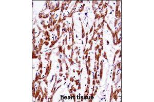 Immunohistochemistry (Formalin/PFA-fixed paraffin-embedded sections) of human heart tissue with TMEM85 polyclonal antibody  followed by peroxidase conjugation of the secondary antibody and DAB staining. (EMC4 Antikörper  (AA 34-62))