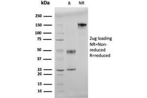 SDS-PAGE Analysis Purified Double Stranded DNA Mouse Monoclonal Antibody (121-3). (dsDNA Antikörper)