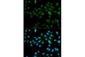 Immunofluorescence analysis of MCF7 cell using CYP11A1 antibody. (CYP11A1 Antikörper  (AA 40-320))