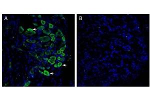 Expression of GPR35 in rat dorsal root ganglion. (GPR35 Antikörper  (Extracellular))