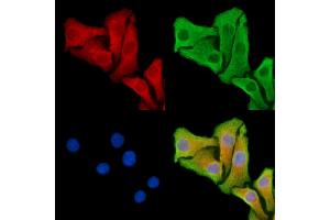 ABIN7095318 and ABIN7099375 staining Hela cells by IF/ICC. (SNX33 Antikörper)