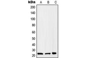 Western blot analysis of RAB2B expression in HepG2 (A), A375 (B), Raw264.