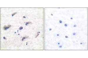 Immunohistochemistry (IHC) image for anti-Microtubule-Associated Protein tau (MAPT) (pSer356) antibody (ABIN2888546) (MAPT Antikörper  (pSer356))