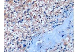 Immunohistochemistry (IHC) image for anti-Inducible T-Cell Co-Stimulator Ligand (ICOSLG) (AA 23-249) antibody (ABIN7439975)