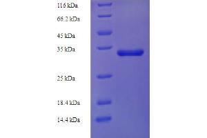 SDS-PAGE (SDS) image for Leukemia, Acute Lymphoblastic, Susceptibility To, 2 (ALL2) (AA 1-159), (full length) protein (His-SUMO Tag) (ABIN5710710) (ALL2 Protein (AA 1-159, full length) (His-SUMO Tag))