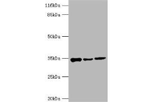 Western blot All lanes: AQP4 antibody at 2 μg/mL Lane 1: Mouse heart tissue Lane 2: Mouse brain tissue Lane 3: Mouse kidney tissue Secondary Goat polyclonal to rabbit IgG at 1/10000 dilution Predicted band size: 35, 33 kDa Observed band size: 35 kDa (Aquaporin 4 Antikörper  (AA 253-323))