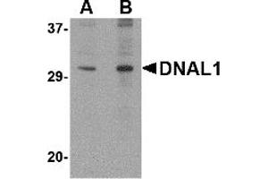 Western Blotting (WB) image for anti-Dynein, Axonemal, Light Chain 1 (DNAL1) (C-Term) antibody (ABIN1030363) (DNAL1 Antikörper  (C-Term))