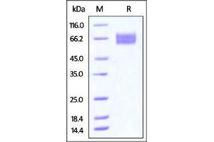 Human EGFRvIII, His Tag on SDS-PAGE under reducing (R) condition. (EGFR Protein (AA 25-378) (His tag))