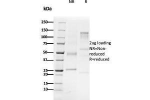 SDS-PAGE Analysis Purified CD79b Mouse Monoclonal Antibody (B29/123). (CD79b Antikörper  (C-Term))