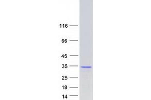 PID1 Protein (Transcript Variant 2) (Myc-DYKDDDDK Tag)