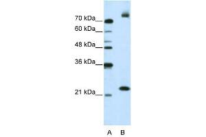 FZD9 antibody used at 2. (FZD9 Antikörper)