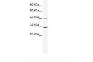 Image no. 1 for anti-Cyclin D3 (CCND3) (C-Term) antibody (ABIN6735965) (Cyclin D3 Antikörper  (C-Term))