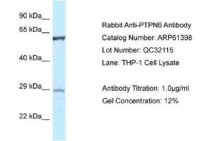 Western Blotting (WB) image for anti-Protein-tyrosine Phosphatase 1C (PTPN6) (Middle Region) antibody (ABIN2788789) (SHP1 Antikörper  (Middle Region))