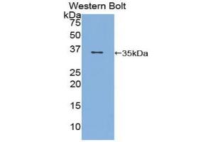 Western blot analysis of the recombinant protein. (CD1d Antikörper  (AA 32-302))
