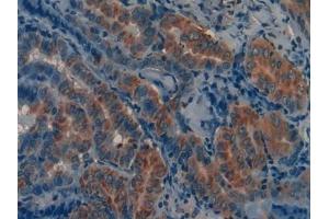 Immunohistochemistry (IHC) image for anti-Matrix Metallopeptidase 12 (Macrophage Elastase) (MMP12) (AA 290-469) antibody (ABIN7431749)