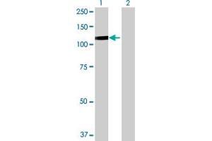 Western Blot analysis of DDX54 expression in transfected 293T cell line by DDX54 MaxPab polyclonal antibody. (DDX54 Antikörper  (AA 1-881))