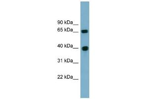 WB Suggested Anti-CCNJ Antibody Titration: 0. (Cyclin J Antikörper  (N-Term))