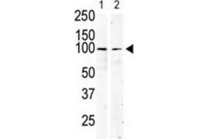 Western Blotting (WB) image for anti-Mast/stem Cell Growth Factor Receptor (KIT) antibody (ABIN5014921) (KIT Antikörper)